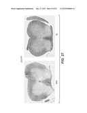 Modulation of Axon Degeneration diagram and image