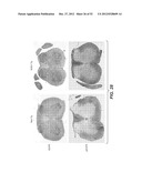 Modulation of Axon Degeneration diagram and image