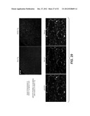 Modulation of Axon Degeneration diagram and image