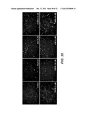 Modulation of Axon Degeneration diagram and image