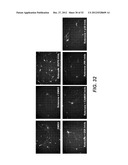 Modulation of Axon Degeneration diagram and image