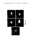 Modulation of Axon Degeneration diagram and image