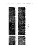 Modulation of Axon Degeneration diagram and image