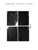 Modulation of Axon Degeneration diagram and image