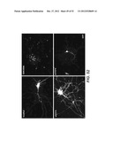 Modulation of Axon Degeneration diagram and image