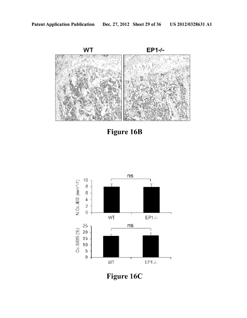 EP1 INHIBITION - diagram, schematic, and image 30