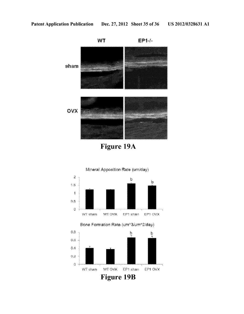 EP1 INHIBITION - diagram, schematic, and image 36