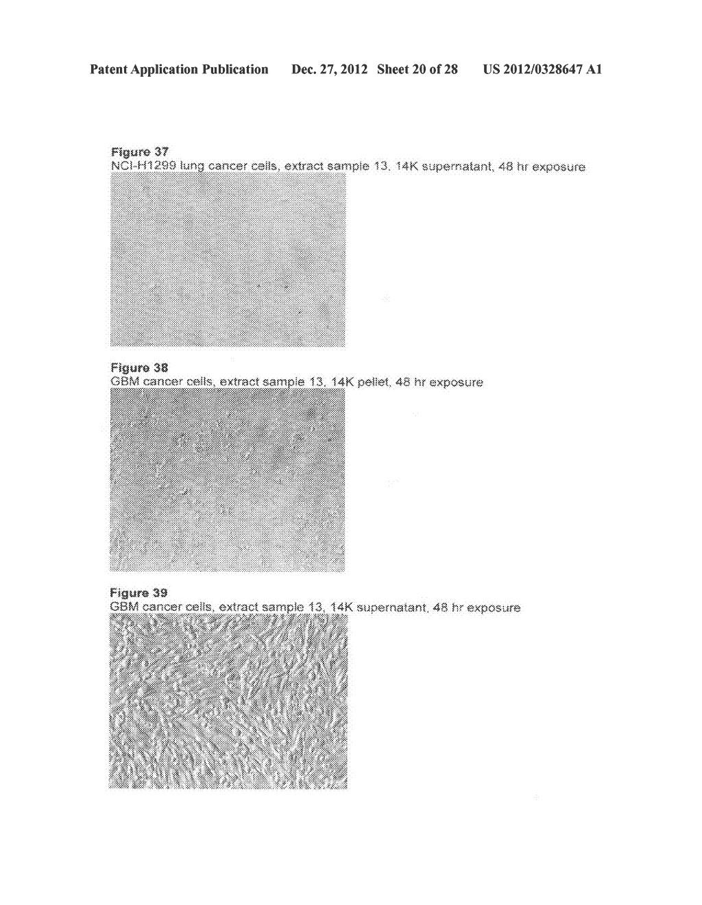 FORMULATIONS COMPRISING EXTRACTS FROM PRIMITIVE PLANT SPECIES (Mosses,     Ferns and Lichens) TO TREAT AND PREVENT CANCERS - diagram, schematic, and image 21