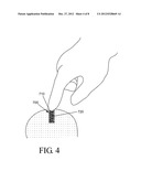 High density fibrous polymers suitable for implant diagram and image