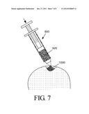 High density fibrous polymers suitable for implant diagram and image