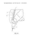 TISSUE MANAGEMENT IMPRESSION MATERIAL AND DISPENSING SYSTEM diagram and image