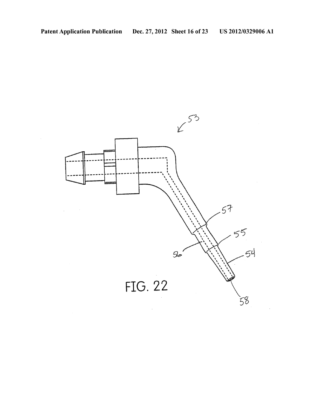 TISSUE MANAGEMENT IMPRESSION MATERIAL AND DISPENSING SYSTEM - diagram, schematic, and image 17