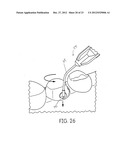 TISSUE MANAGEMENT IMPRESSION MATERIAL AND DISPENSING SYSTEM diagram and image