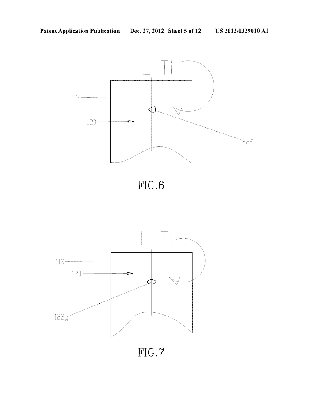 WINGED IMPLANT - diagram, schematic, and image 06