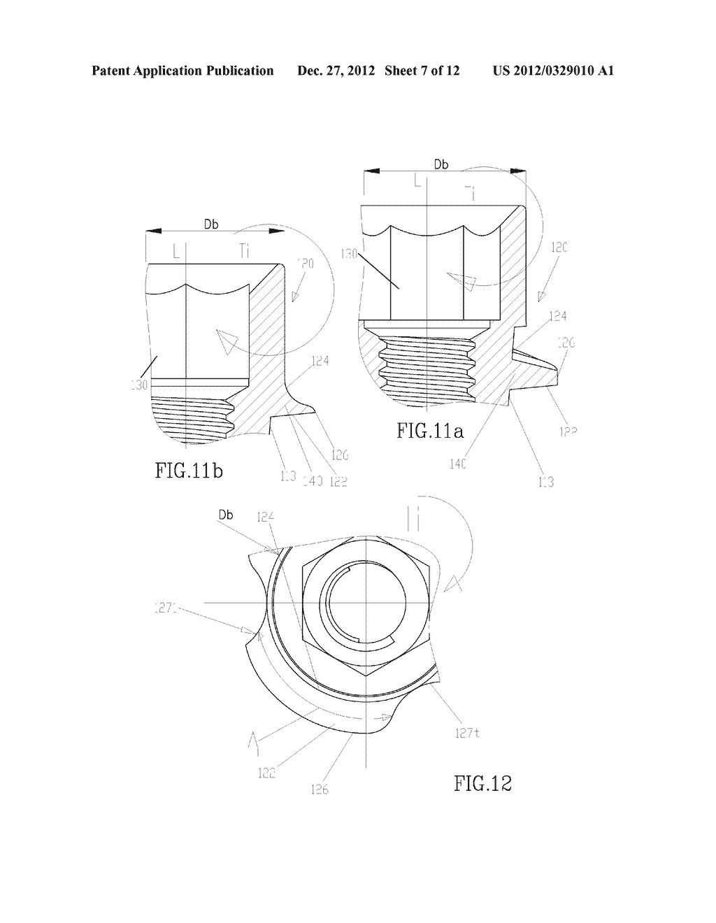WINGED IMPLANT - diagram, schematic, and image 08