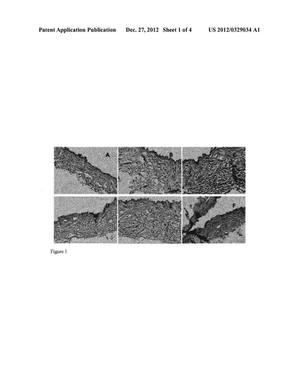Method For Producing An Acellular Dermal Matrix, And Acellular Dermal     Matrix Produced By Same - diagram, schematic, and image 02