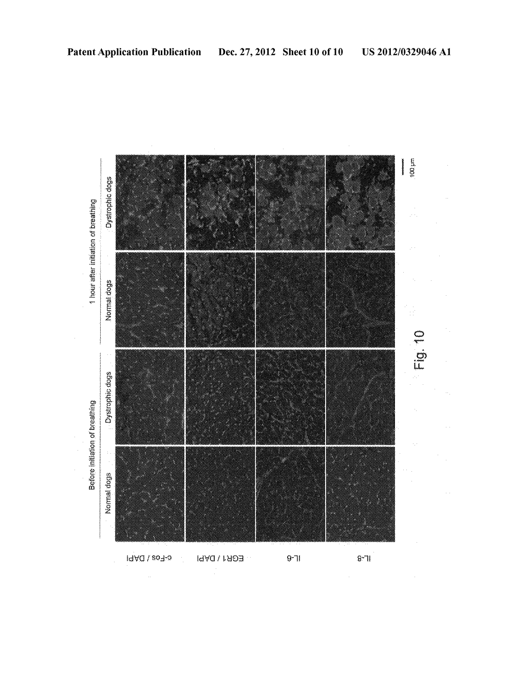 MOLECULAR MARKER FOR EVALUATING PATHOLOGICAL CONDITIONS AND TREATMENT OF     MUSCULAR DYSTROPHY - diagram, schematic, and image 11