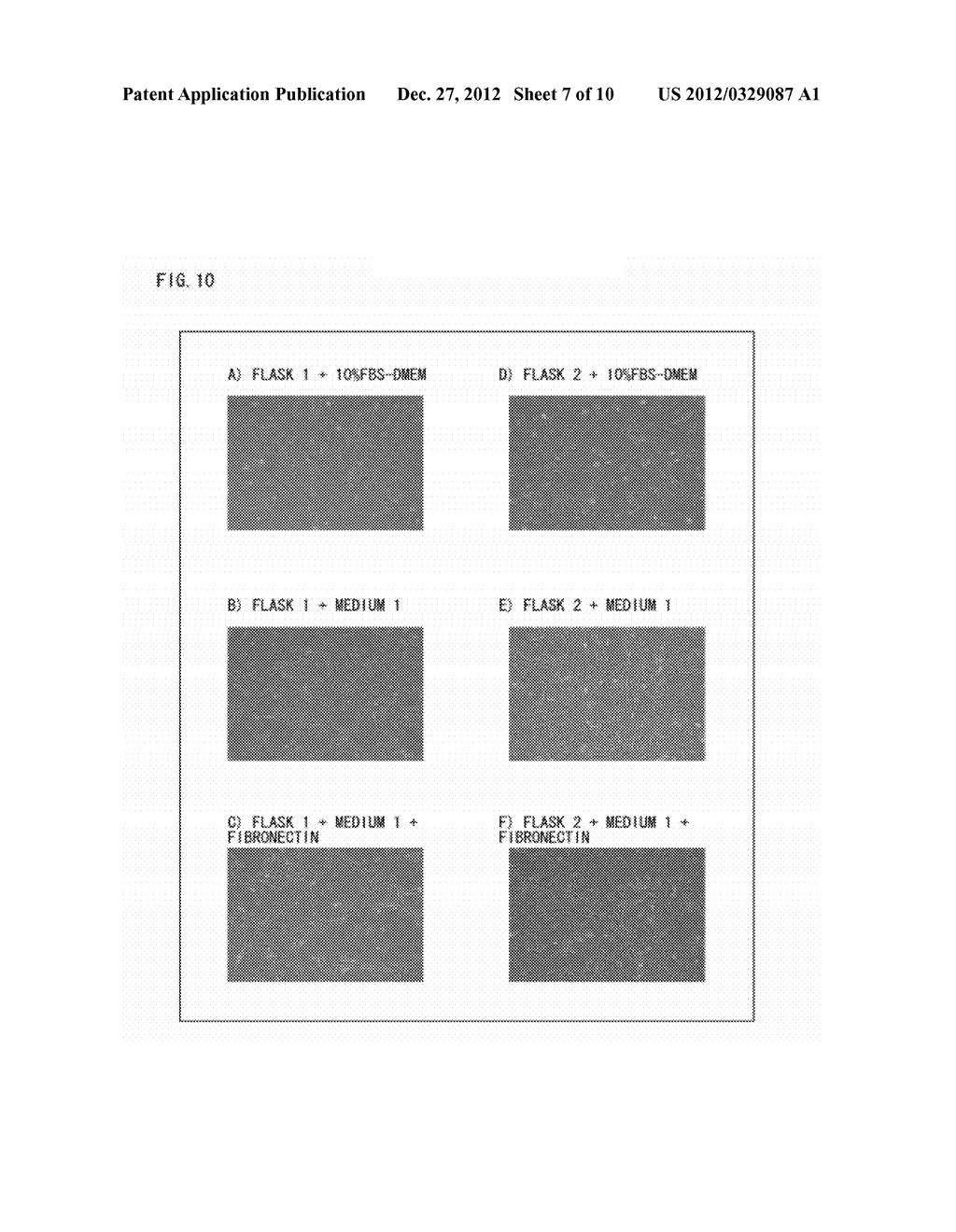 CELL PREPARATION CONTAINING MESENCHYMAL STEM CELLS, AND METHOD FOR     PRODUCING SAME - diagram, schematic, and image 08