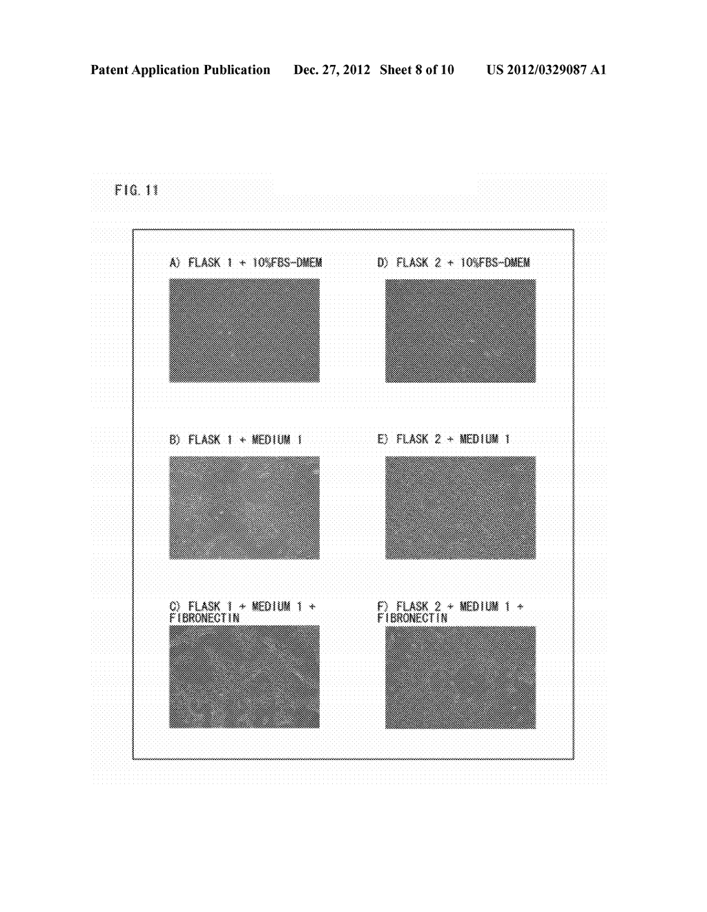 CELL PREPARATION CONTAINING MESENCHYMAL STEM CELLS, AND METHOD FOR     PRODUCING SAME - diagram, schematic, and image 09