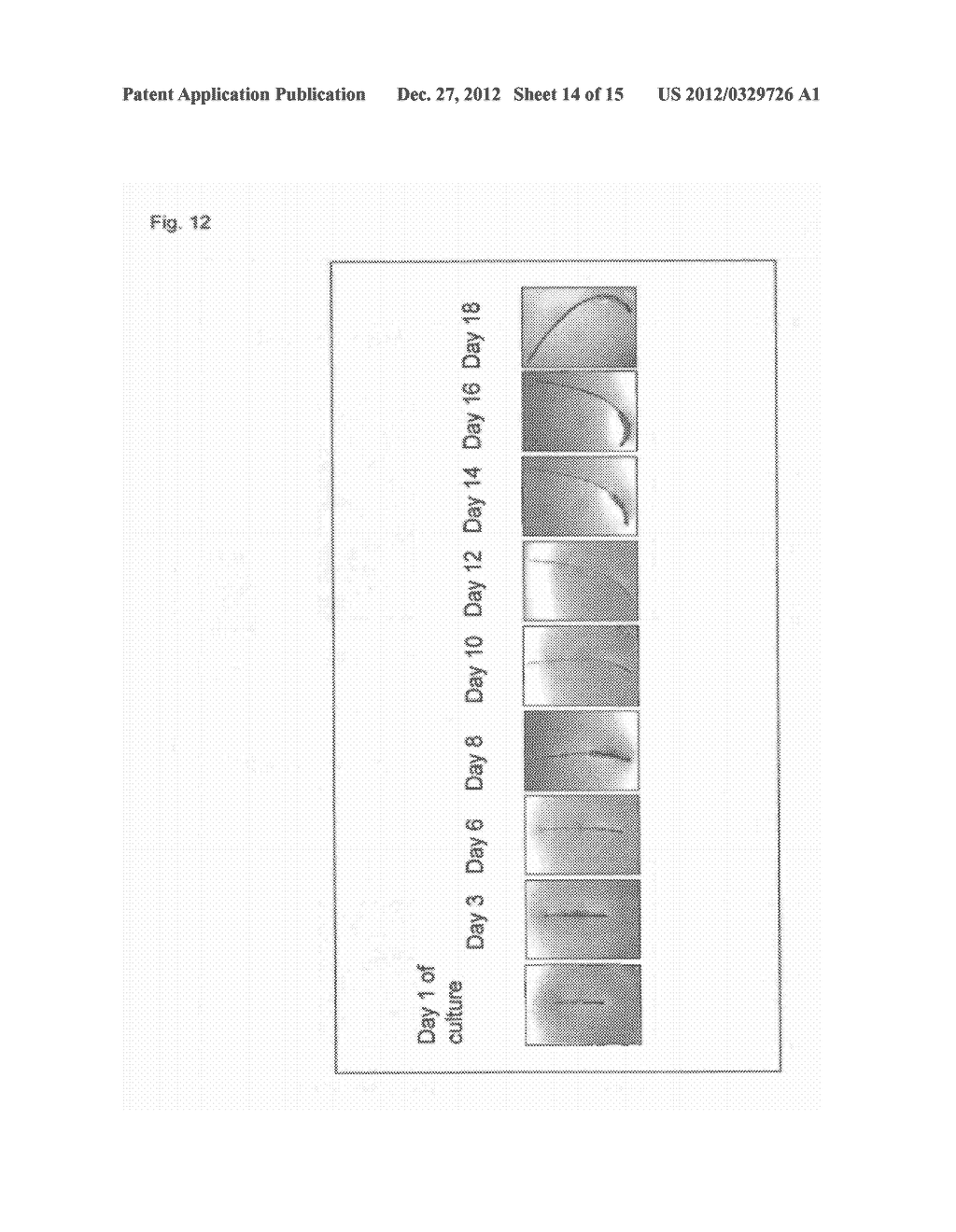 Hair Shape Susceptibility Gene - diagram, schematic, and image 15