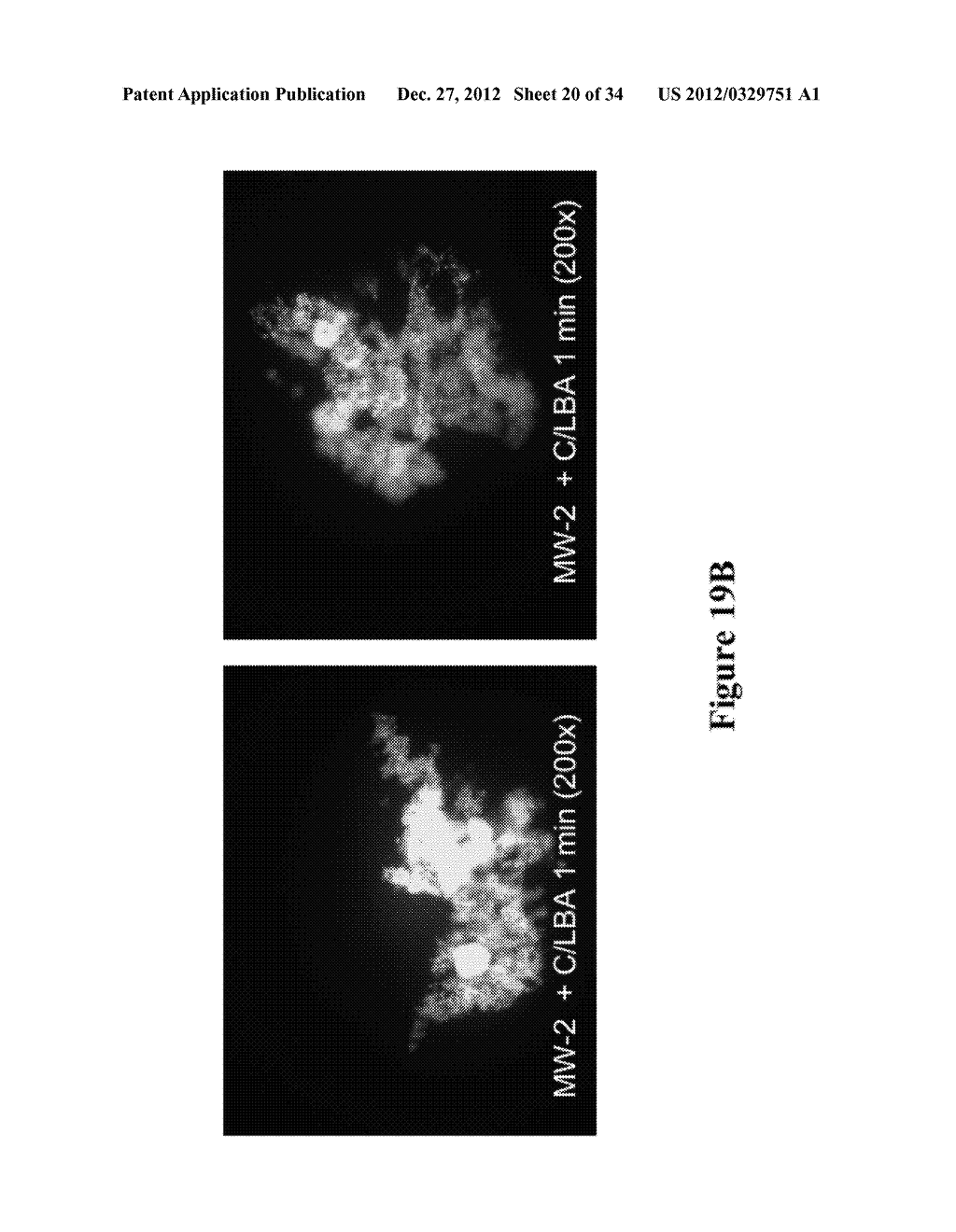 METHODS AND COMPOSITIONS FOR DISRUPTING BIOFILM UTILIZING     CHITOSAN-DERIVATIVE COMPOUNDS - diagram, schematic, and image 21
