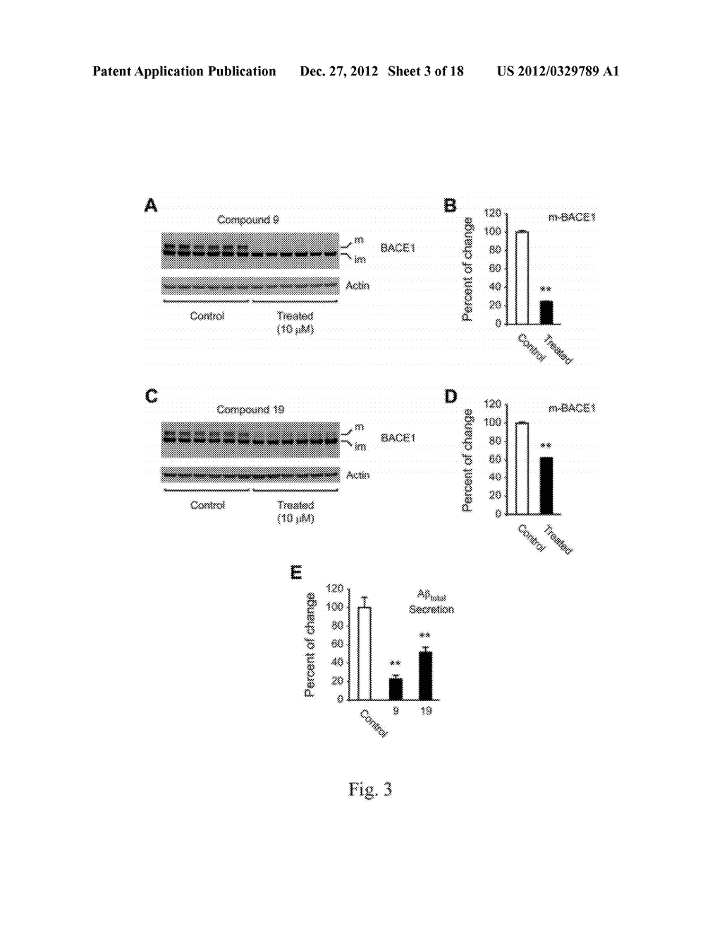 COMPOSITIONS AND METHODS FOR TREATING ALZHEIMERS DISEASE - diagram, schematic, and image 04