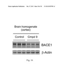 COMPOSITIONS AND METHODS FOR TREATING ALZHEIMERS DISEASE diagram and image