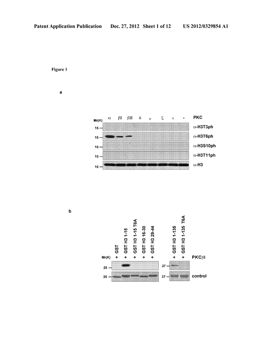 Methods and Compounds for the Diagnosis and Treatment for Cancer - diagram, schematic, and image 02