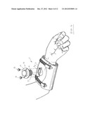 ORTHOPAEDIC DEVICE AND METHOD OF USE FOR TREATING BONE FRACTURES diagram and image