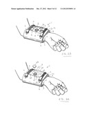 ORTHOPAEDIC DEVICE AND METHOD OF USE FOR TREATING BONE FRACTURES diagram and image