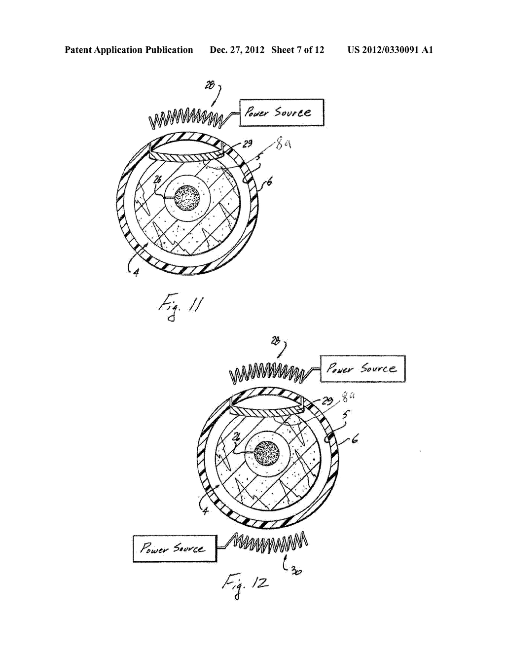 ORTHOPAEDIC DEVICE AND METHOD OF USE FOR TREATING BONE FRACTURES - diagram, schematic, and image 08