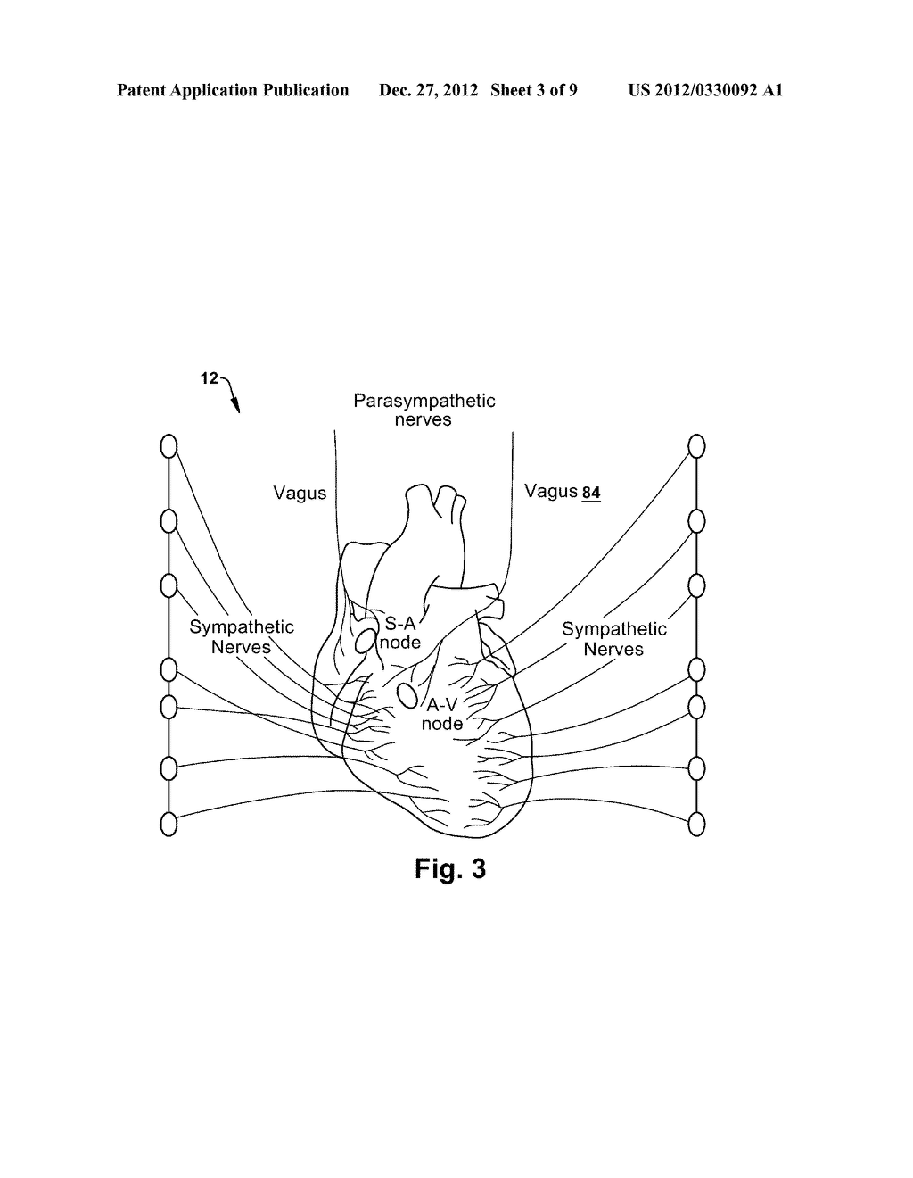 DEVICE, SYSTEM, AND METHOD FOR MODULATING CARDIAC FUNCTION - diagram, schematic, and image 04