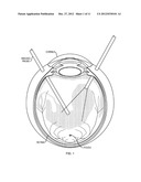 Scanning Endoscopic Imaging Probes and Related Methods diagram and image