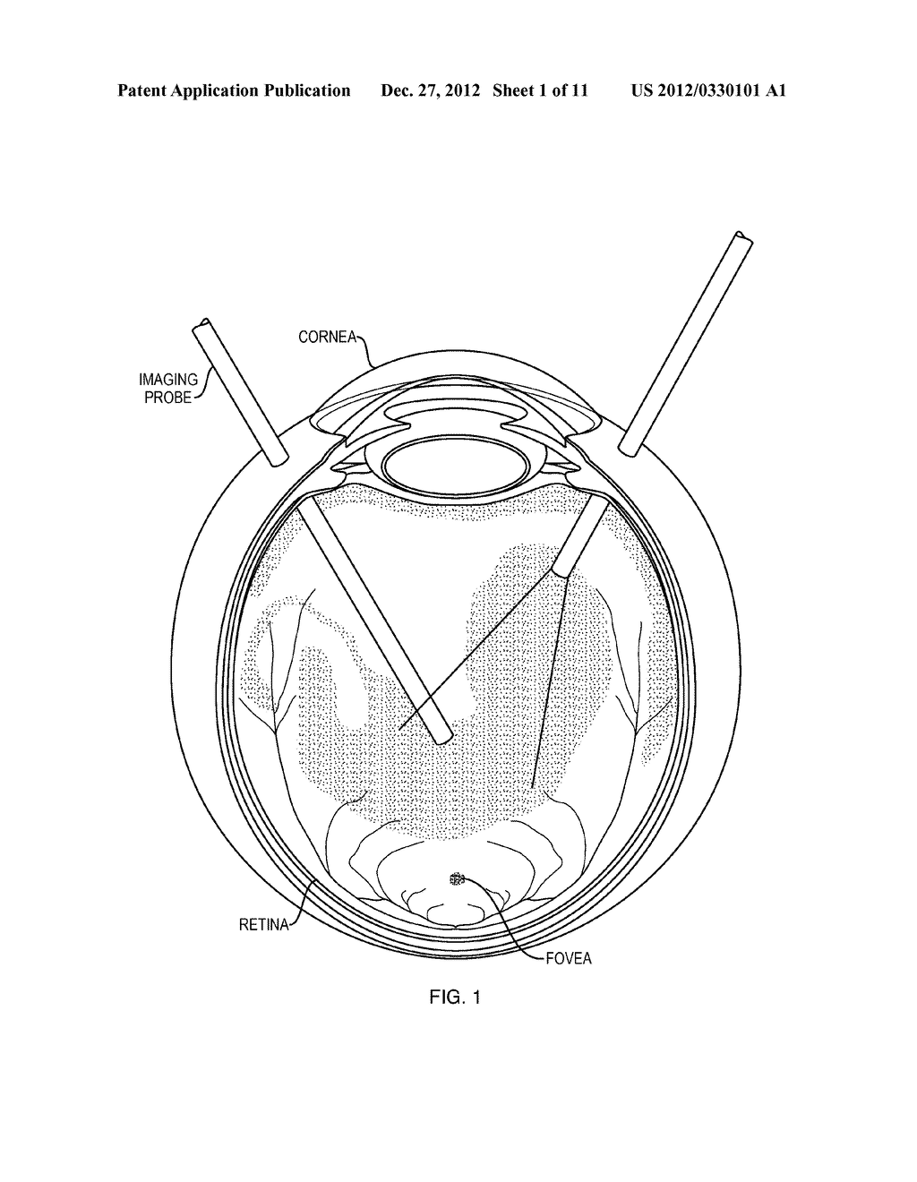 Scanning Endoscopic Imaging Probes and Related Methods - diagram, schematic, and image 02