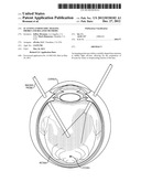 Scanning Endoscopic Imaging Probes and Related Methods diagram and image