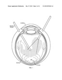 Scanning Endoscopic Imaging Probes and Related Methods diagram and image