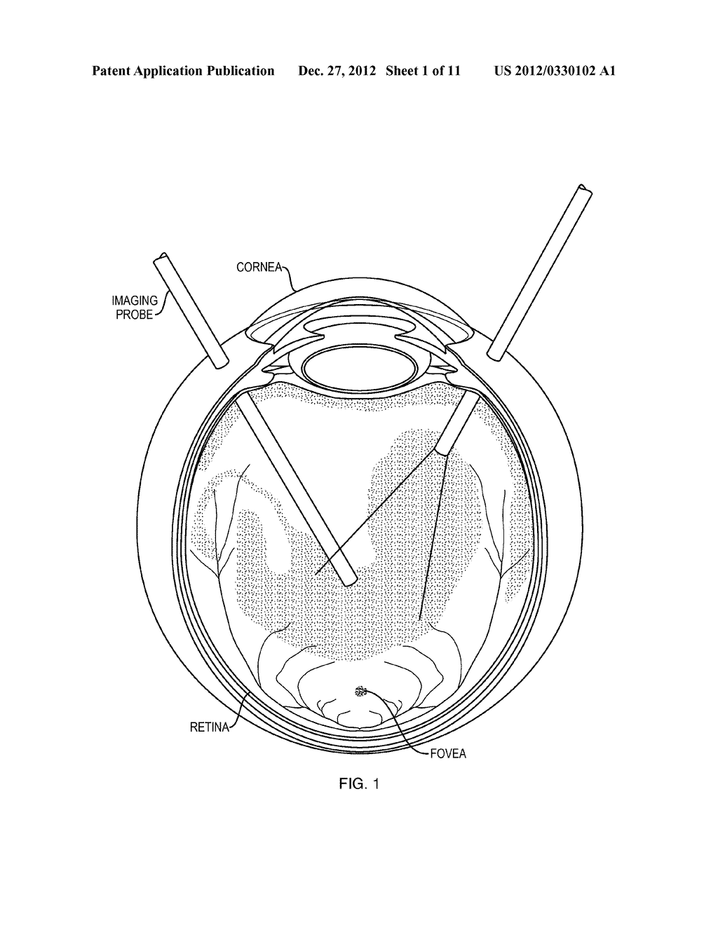 Scanning Endoscopic Imaging Probes and Related Methods - diagram, schematic, and image 02