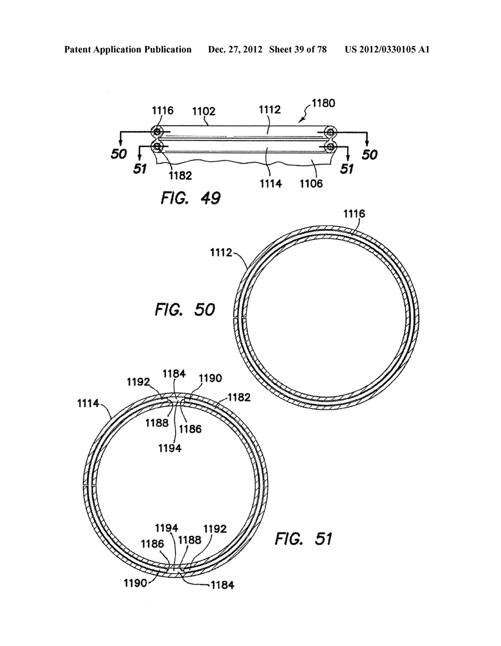 WOUND RETRACTOR WITH GEL CAP - diagram, schematic, and image 40