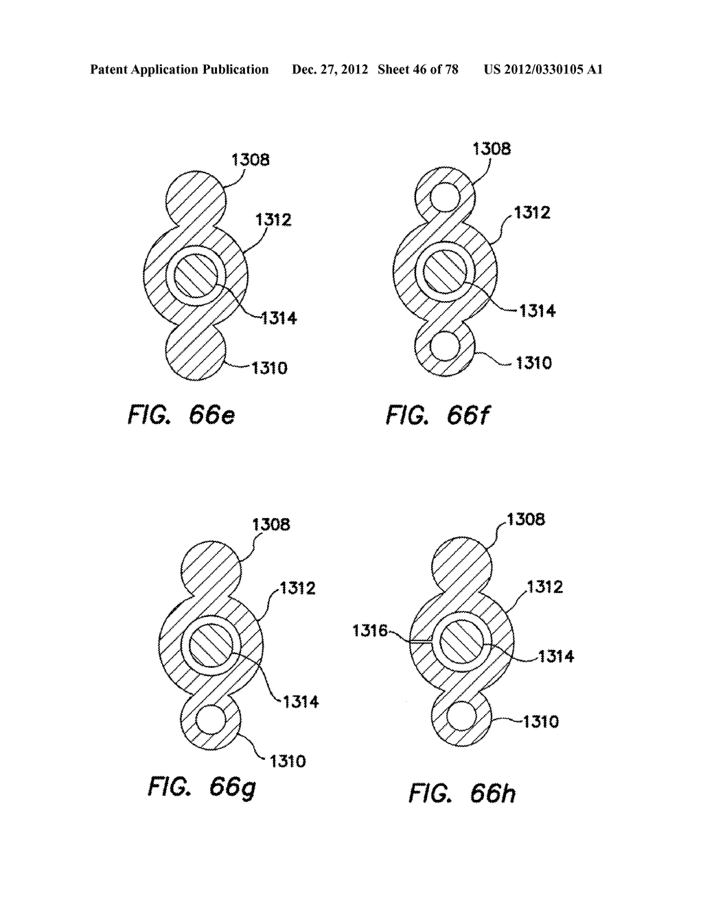 WOUND RETRACTOR WITH GEL CAP - diagram, schematic, and image 47