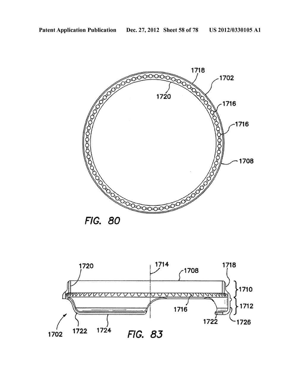 WOUND RETRACTOR WITH GEL CAP - diagram, schematic, and image 59