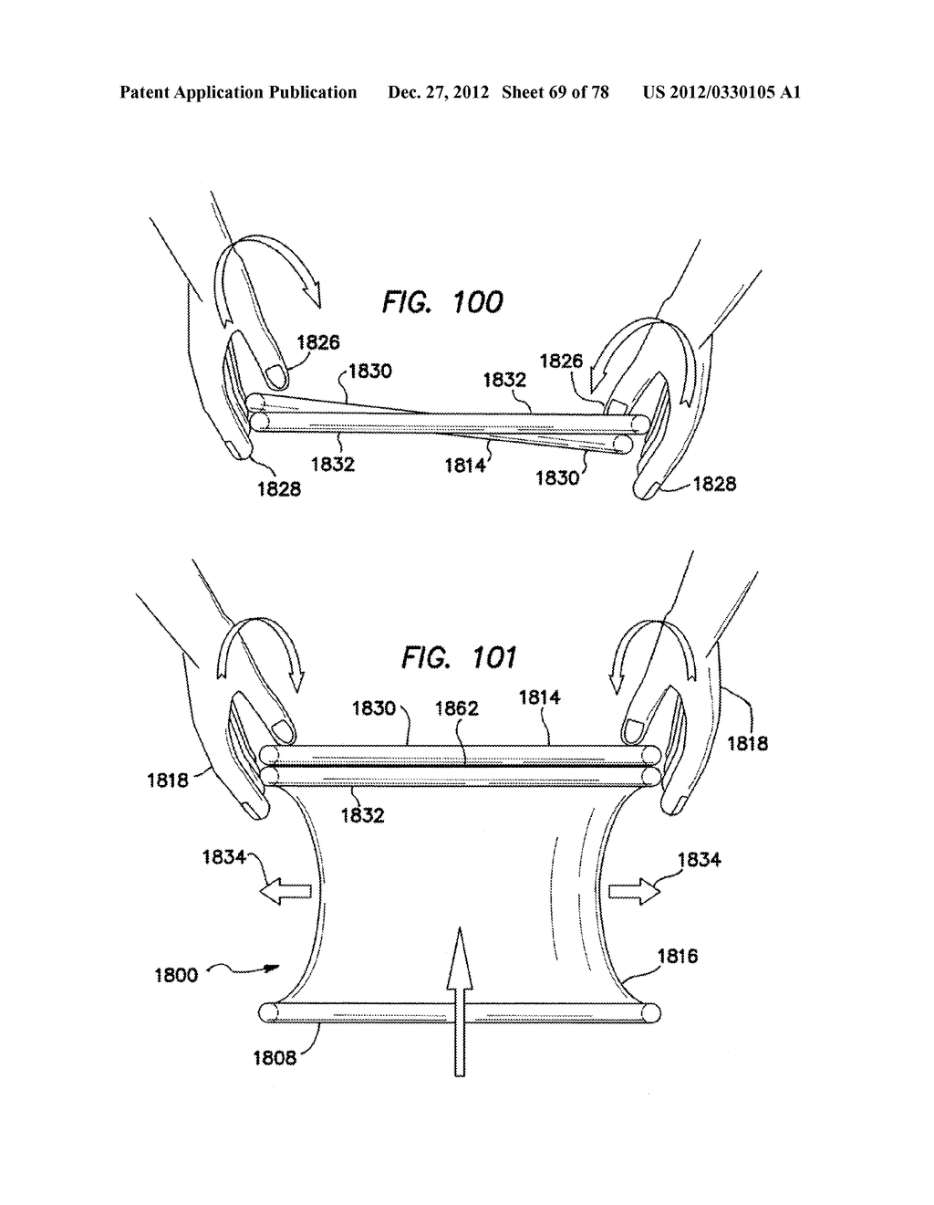 WOUND RETRACTOR WITH GEL CAP - diagram, schematic, and image 70