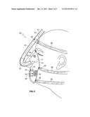 MASK FOR USE WITH A PATIENT UNDERGOING A SEDATED ENDOSCOPIC PROCEDURE diagram and image