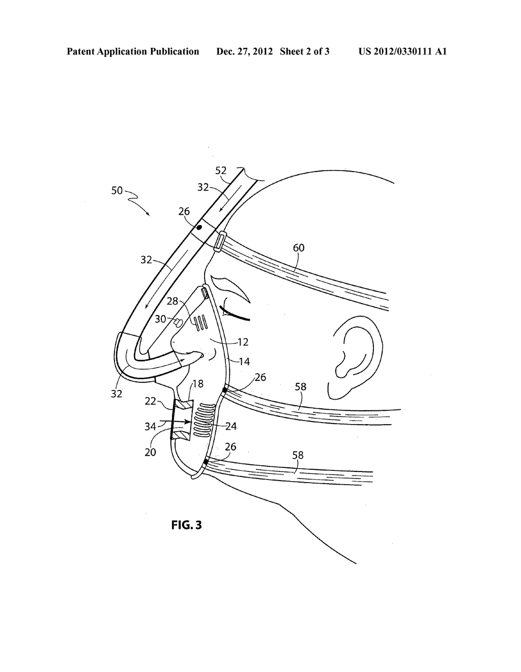 MASK FOR USE WITH A PATIENT UNDERGOING A SEDATED ENDOSCOPIC PROCEDURE - diagram, schematic, and image 03