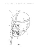 MASK FOR USE WITH A PATIENT UNDERGOING A SEDATED ENDOSCOPIC PROCEDURE diagram and image