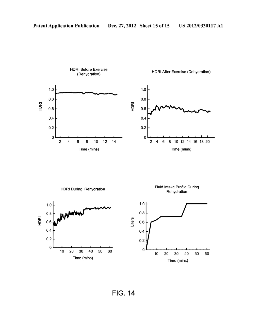 Hemodynamic Reserve Monitor and Hemodialysis Control - diagram, schematic, and image 16