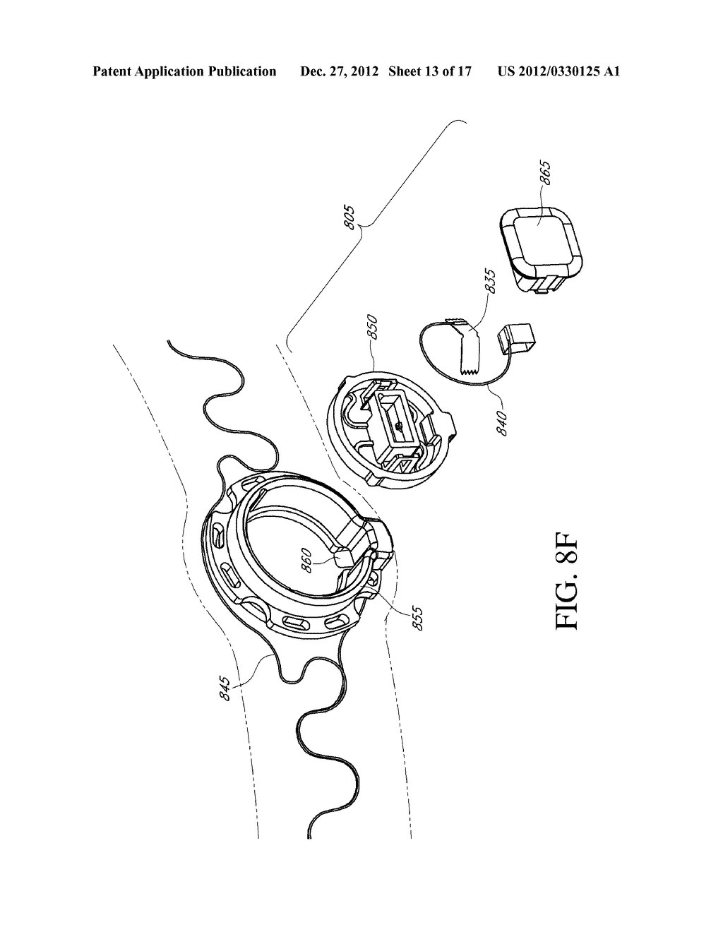 Method And Device For Quick Press On EEG Electrode - diagram, schematic, and image 14