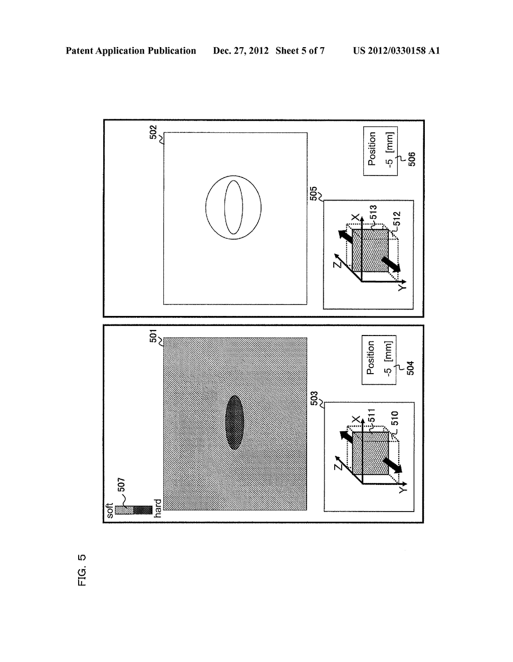 ULTRASONIC DIAGNOSTIC APPARATUS AND ULTRASONIC IMAGE DISPLAY METHOD - diagram, schematic, and image 06
