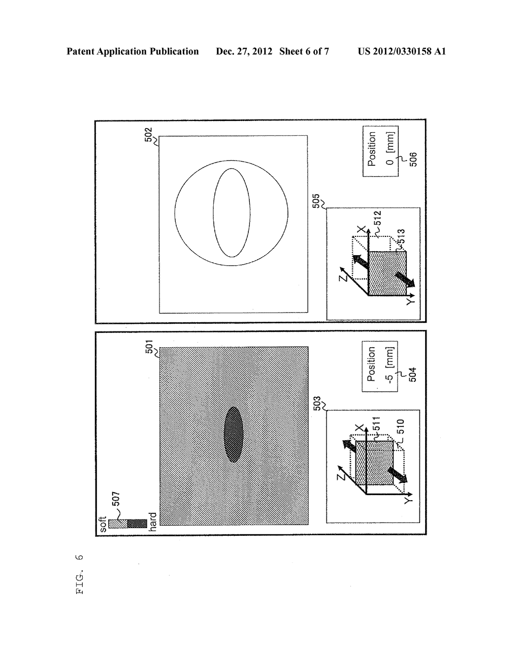ULTRASONIC DIAGNOSTIC APPARATUS AND ULTRASONIC IMAGE DISPLAY METHOD - diagram, schematic, and image 07