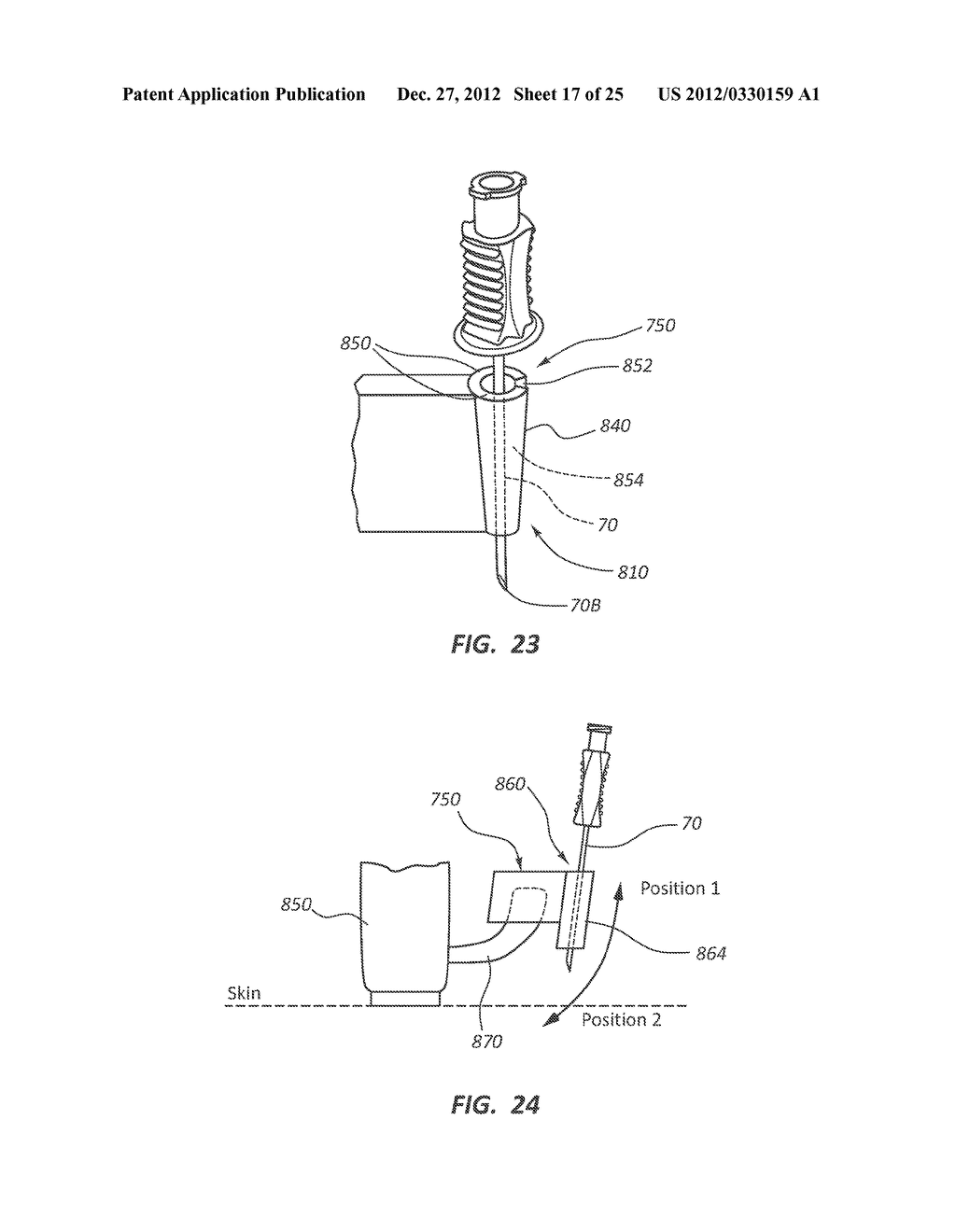 Needle Guide with Selectable Aspects - diagram, schematic, and image 18