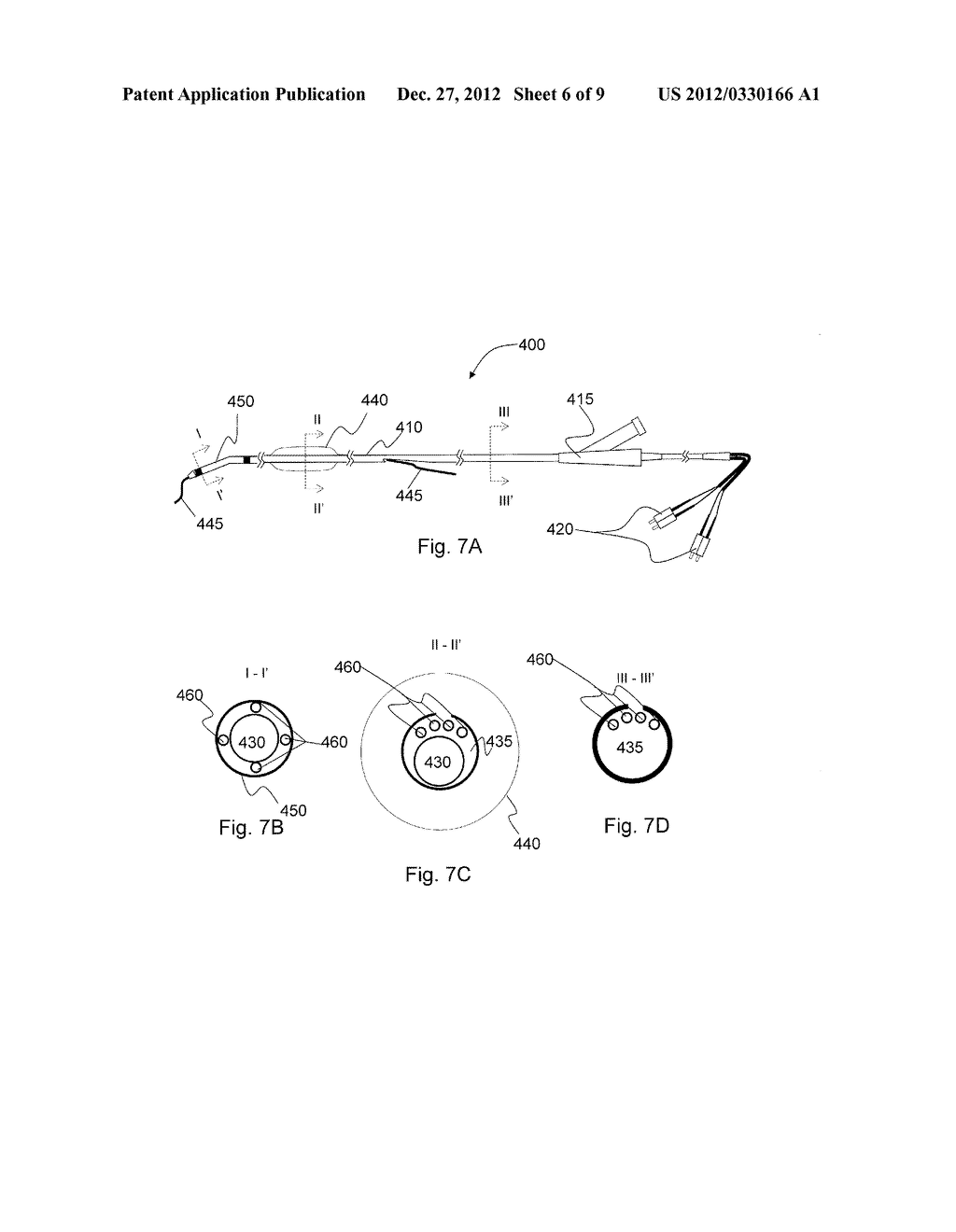 SYSTEMS AND METHODS FOR ANALYSIS AND TREATMENT OF AN OCCLUDED BODY LUMEN - diagram, schematic, and image 07